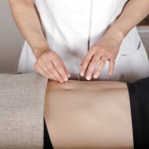 Acupuntura Enérgetica Barcelona -Julia Valiente Acupuntura en Barcelona