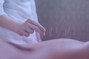 Acupuntura en Donostia » Dra. Izaguirre Acupuntura en San Sebastián
