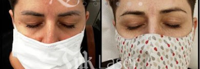 Ink Laser – Alicante (Alacant)