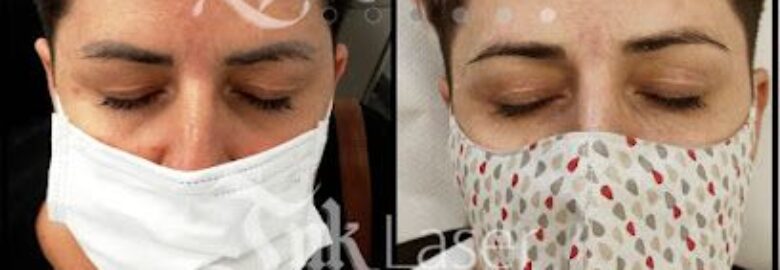 Ink Laser – Valencia
