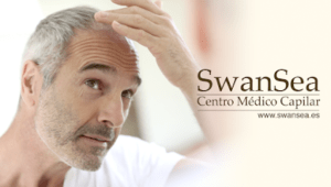 Swansea Clínica Capilar Tratamiento Capilar en Santander
