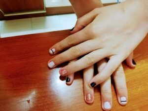 Beauté Clinic - Estética Domi Tratamiento de Acné en Palencia