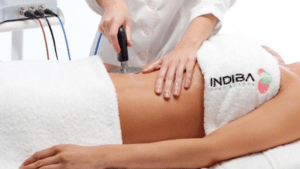 Centro de Estética Abril - Tratamientos Indiba Tratamiento de Acné en Gijón