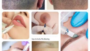 Centro de Estética Alejandra Motta Microdermoabrasión en Jerez de la Frontera