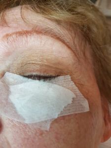 Centro de Estética Celulitis Tratamiento Celulitis en Allande