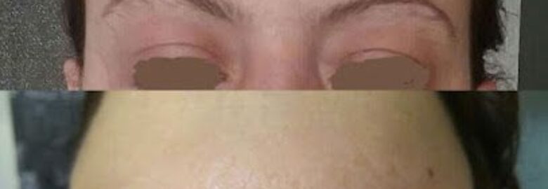 Centro Estético Microblading Guinot – Alicante (Alacant)