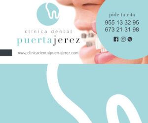 Clinica Dental Puerta Jerez Colocación de Brackets en Sevilla