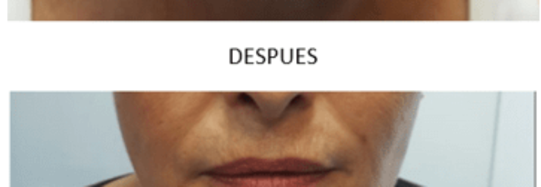 Clínica Doctora Andrea Cepeda, Medicina Estética. – Madrid