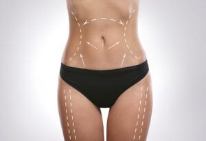 Clinica Dra Blanco Clínica Reducción Corporal en Salamanca