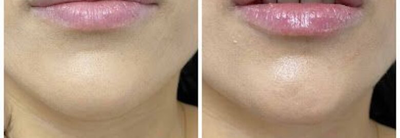 Clínica Estética Dra Yasmin Al Adib – Ibiza