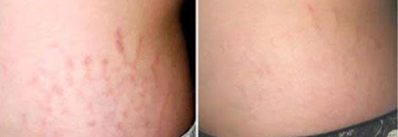 Clínica Médico Estética Belleza & Arte – Granada