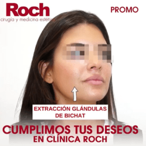 Clínica Roch Tratamiento de Acné en Sevilla