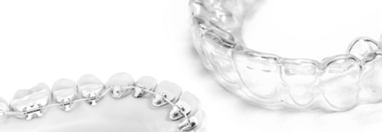 Clinica Sevilla Ortodoncia invisible Dra. Pilar Martin Balbuena – Sevilla