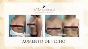 Clinica Vimedical - Centro de Medicina Estética y Cirugía Plástica Tratamiento Capilar en Badajoz
