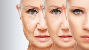 Clínica Vitabel - Medicina Estética Mesoterapia en Huelva