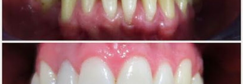 Denty Dent – Bravo Murillo Clínica Dental – Madrid