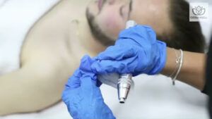 Dermabell Centro Estético Tratamiento Celulitis en Segovia