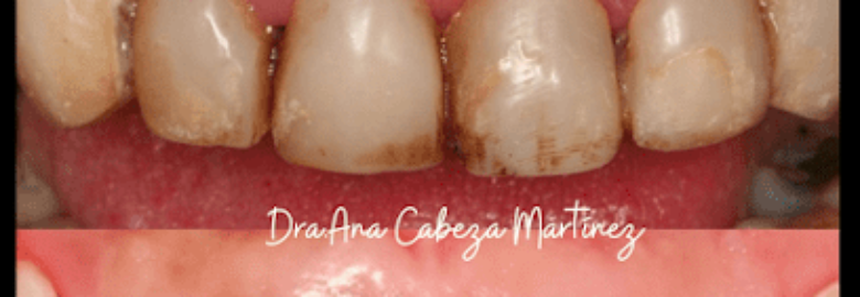 Instituto White Smiles – Majadahonda