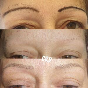 Micro Clara Dan Maquillaje Permanente en Badajoz