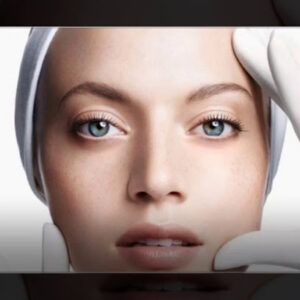 Stetika medicina Estética Microdermoabrasión en Madrid