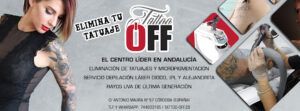 Tattoo Off Eliminar Estrías en Córdoba
