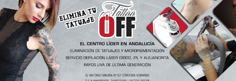 Tattoo Off – Córdoba